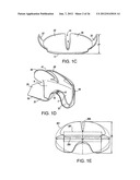 COLLAPSIBLE BARRIER FOR ORGAN RETENTION AND METHOD OF USE diagram and image