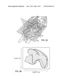 COLLAPSIBLE BARRIER FOR ORGAN RETENTION AND METHOD OF USE diagram and image