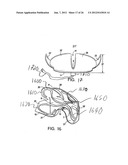 COLLAPSIBLE BARRIER FOR ORGAN RETENTION AND METHOD OF USE diagram and image