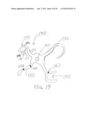 COLLAPSIBLE BARRIER FOR ORGAN RETENTION AND METHOD OF USE diagram and image