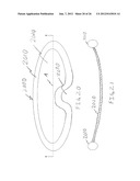 COLLAPSIBLE BARRIER FOR ORGAN RETENTION AND METHOD OF USE diagram and image