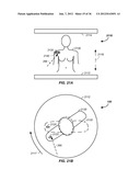 MULTI-FIELD CHARGED PARTICLE CANCER THERAPY METHOD AND APPARATUS     COORDINATED WITH PATIENT RESPIRATION diagram and image