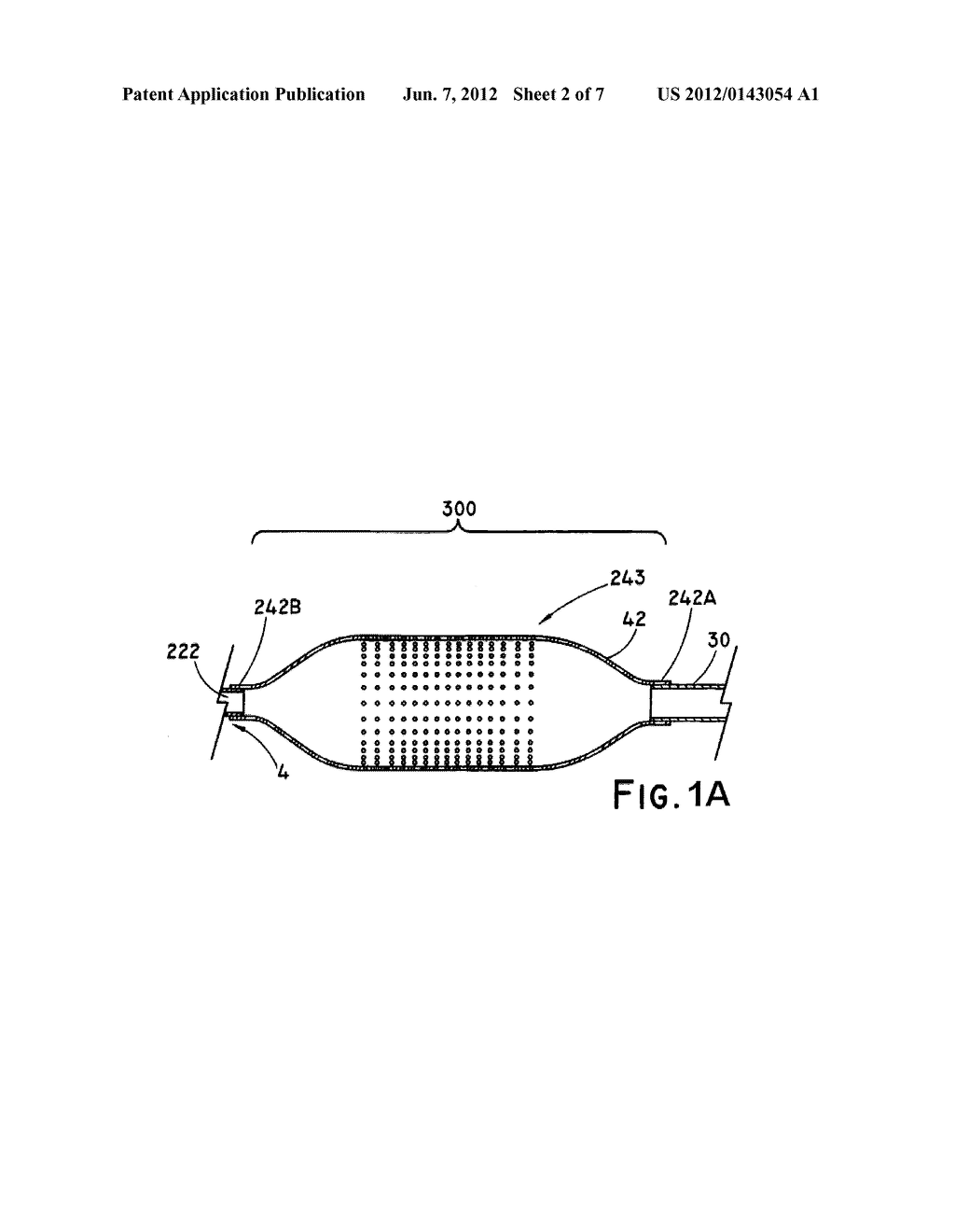 COATED BALLOON CATHETER - diagram, schematic, and image 03