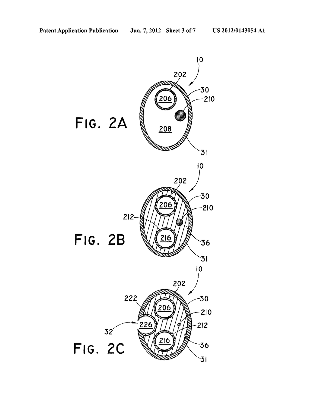 COATED BALLOON CATHETER - diagram, schematic, and image 04