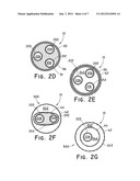 COATED BALLOON CATHETER diagram and image