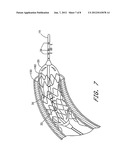 DEVICES AND SYSTEMS TO MEASURE LUMINAL ORGAN PARAMETERS USING IMPEDANCE diagram and image