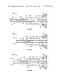 VACUUM ASSISTED LANCING SYSTEM WITH ELECTIVE VACUUM RELEASE AND METHOD FOR     BLOOD EXTRACTION WITH MINIMAL PAIN diagram and image