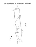 VACUUM ASSISTED LANCING SYSTEM WITH ELECTIVE VACUUM RELEASE AND METHOD FOR     BLOOD EXTRACTION WITH MINIMAL PAIN diagram and image