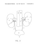 TREATMENT OF ATRIAL FIBRILLATION USING HIGH-FREQUENCY PACING AND ABLATION     OF RENAL NERVES diagram and image