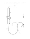 TREATMENT OF ATRIAL FIBRILLATION USING HIGH-FREQUENCY PACING AND ABLATION     OF RENAL NERVES diagram and image