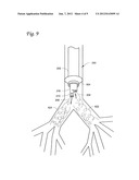 SYSTEMS AND METHODS FOR IMPAIRING SMOOTH MUSCLE TISSUE FUNCTION diagram and image