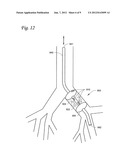 SYSTEMS AND METHODS FOR IMPAIRING SMOOTH MUSCLE TISSUE FUNCTION diagram and image