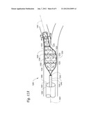 SYSTEMS AND METHODS FOR IMPAIRING SMOOTH MUSCLE TISSUE FUNCTION diagram and image