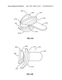 SYSTEM FOR PROVIDING HEAT TREATMENT AND HEAT LOSS REDUCTION FOR TREATING     MEIBOMIAN GLAND DYSFUNCTION diagram and image