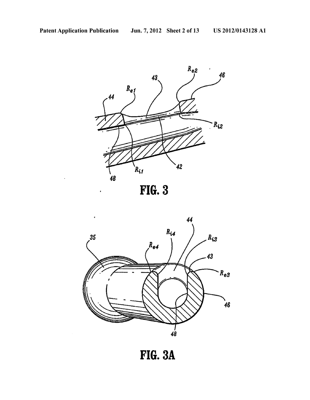 Catheter - diagram, schematic, and image 03