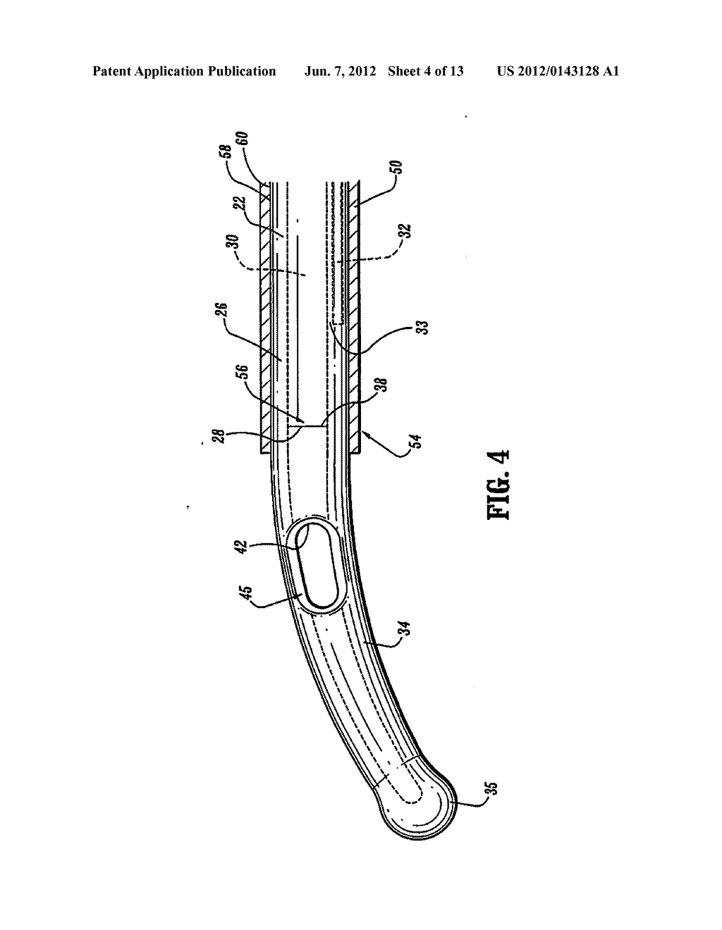 Catheter - diagram, schematic, and image 05