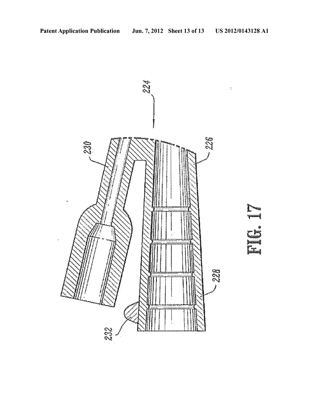 Catheter - diagram, schematic, and image 14