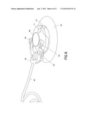 Insulin Pump Dermal Infusion Set Having Partially Integrated Mechanized     Cannula Insertion With Disposable Activation Portion diagram and image