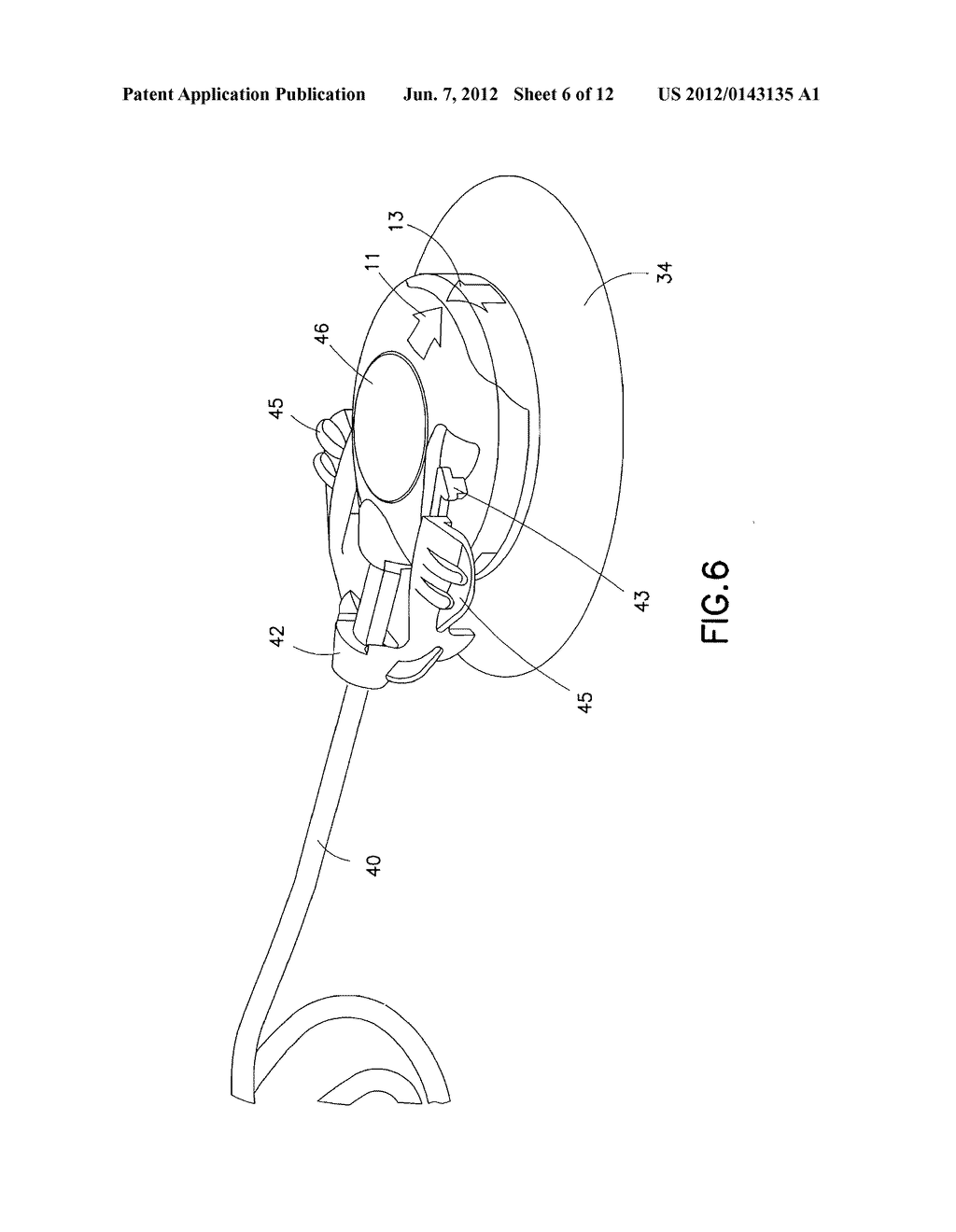 Insulin Pump Dermal Infusion Set Having Partially Integrated Mechanized     Cannula Insertion With Disposable Activation Portion - diagram, schematic, and image 07