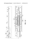 AGENT DELIVERY CATHETER HAVING A RADIALLY EXPANDABLE CENTERING SUPPORT     MEMBER diagram and image