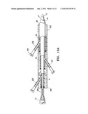 AGENT DELIVERY CATHETER HAVING A RADIALLY EXPANDABLE CENTERING SUPPORT     MEMBER diagram and image