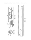 AGENT DELIVERY CATHETER HAVING A RADIALLY EXPANDABLE CENTERING SUPPORT     MEMBER diagram and image