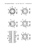 AGENT DELIVERY CATHETER HAVING A RADIALLY EXPANDABLE CENTERING SUPPORT     MEMBER diagram and image