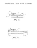 CATHETER INCLUDING A UNIBODY DISTAL GUIDEWIRE PORT AND METHOD OF     MANUFACTURE diagram and image