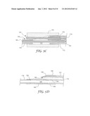 CATHETER INCLUDING A UNIBODY DISTAL GUIDEWIRE PORT AND METHOD OF     MANUFACTURE diagram and image