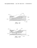 CATHETER INCLUDING A UNIBODY DISTAL GUIDEWIRE PORT AND METHOD OF     MANUFACTURE diagram and image