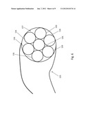 LASER SYSTEMS AND METHODS FOR VAPORIZATION OF PROSTATE AND OTHER TISSUE diagram and image