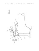 FEMORAL SIZING INSTRUMENT diagram and image