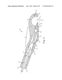 SUTURE SYSTEM AND ASSEMBLY diagram and image