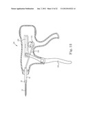 SUTURE SYSTEM AND ASSEMBLY diagram and image