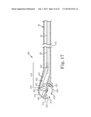 SUTURE SYSTEM AND ASSEMBLY diagram and image