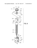 BONE SCREW SYSTEM diagram and image