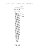 BONE SCREW SYSTEM diagram and image