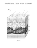 METHODS AND DEVICES FOR TREATING TISSUE diagram and image