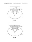 METHODS AND DEVICES FOR TREATING TISSUE diagram and image