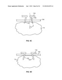 METHODS AND DEVICES FOR TREATING TISSUE diagram and image