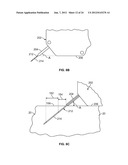 METHODS AND DEVICES FOR TREATING TISSUE diagram and image