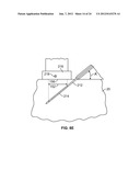 METHODS AND DEVICES FOR TREATING TISSUE diagram and image