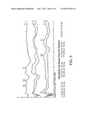 Synchronized Diagnostic Measurement for Cochlear Implants diagram and image