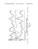 Synchronized Diagnostic Measurement for Cochlear Implants diagram and image