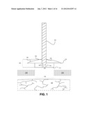 LEAD FIXATION DEVICE FOR SECURING A MEDICAL LEAD IN A HUMAN PATIENT diagram and image