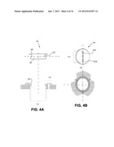 LEAD FIXATION DEVICE FOR SECURING A MEDICAL LEAD IN A HUMAN PATIENT diagram and image