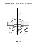 LEAD FIXATION DEVICE FOR SECURING A MEDICAL LEAD IN A HUMAN PATIENT diagram and image