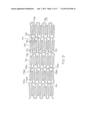 LONGITUDINALLY FLEXIBLE EXPANDABLE STENT diagram and image