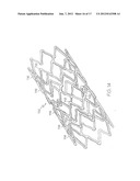 LONGITUDINALLY FLEXIBLE EXPANDABLE STENT diagram and image