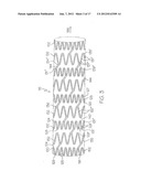 LONGITUDINALLY FLEXIBLE EXPANDABLE STENT diagram and image